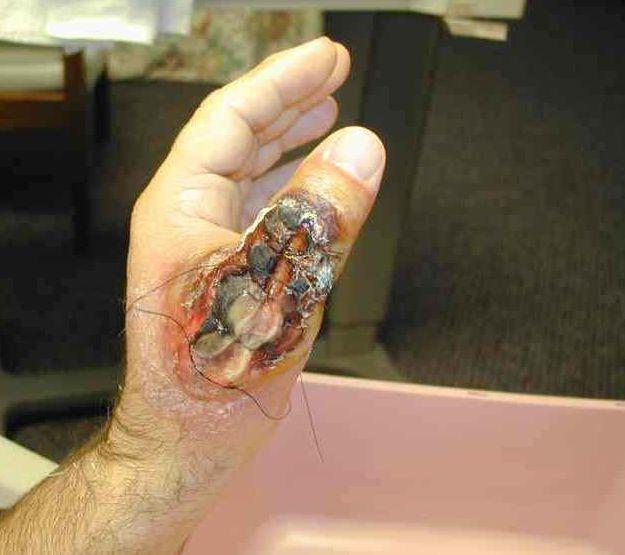 Characteristics Of Dog Bites Characteristics Of Dog Bites